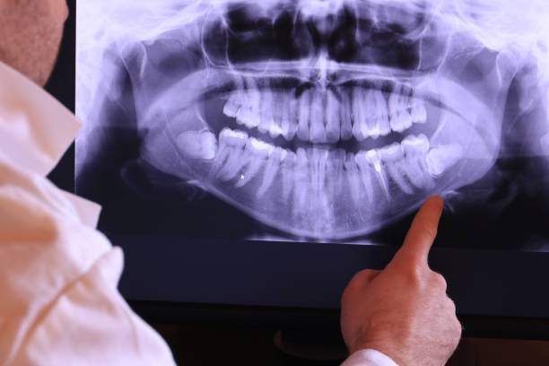 Best Emergency Gum Pain Relief  in Spring City, UT